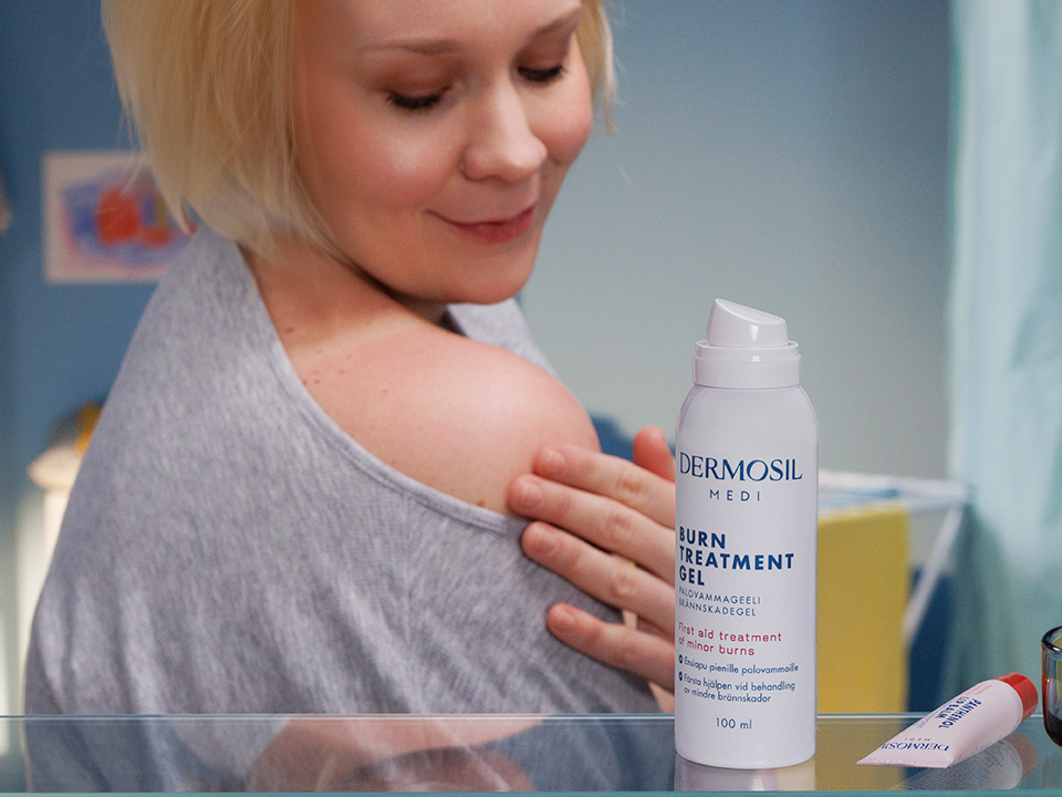 Palovamman ensiapu – Näin hoidat palovamman oikein