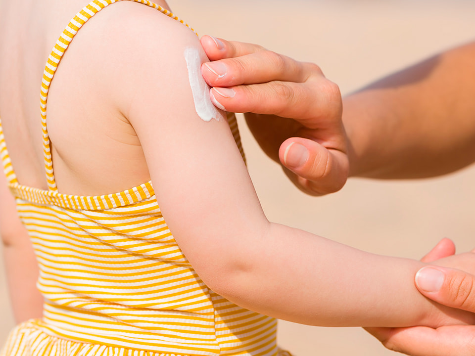 Suojaa ihoa auringolta