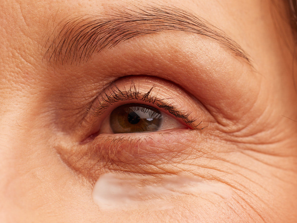 Silmänympärysvoide ikääntyvälle iholle